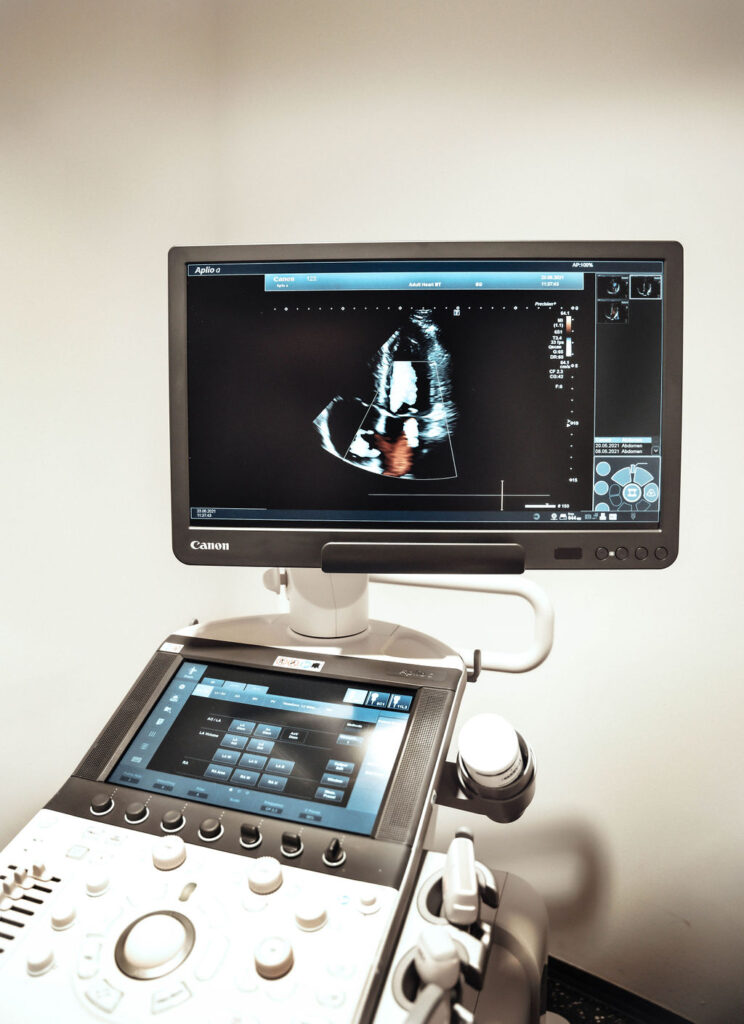Ultraschall | Kardiologische Praxis Innsbruck, Dr. Schwarzl Ultraschall | Kardiologische Praxis Innsbruck, Dr. Schwarzl